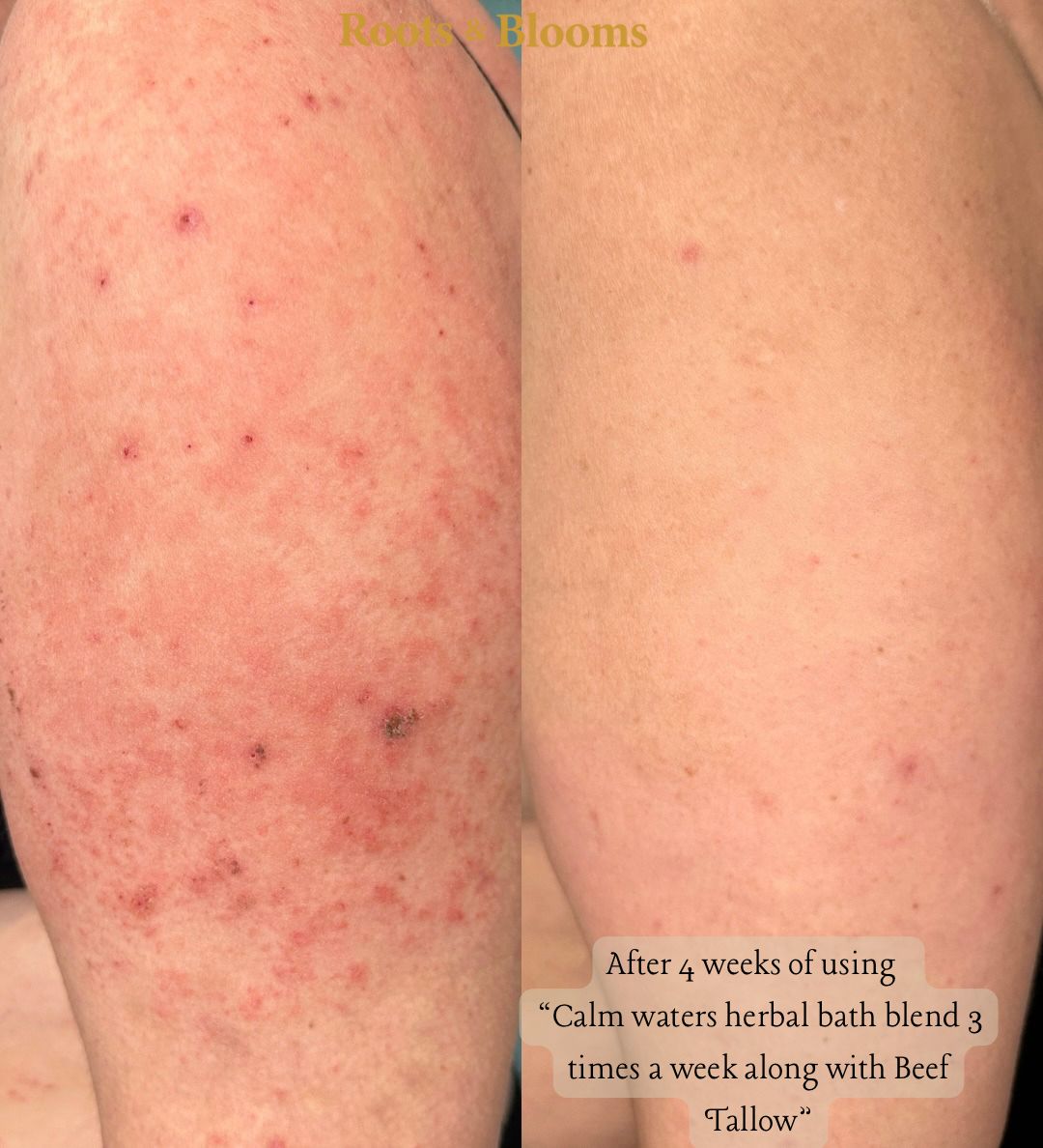 Calm Waters (Pre-Made Herbal Bath Blend)